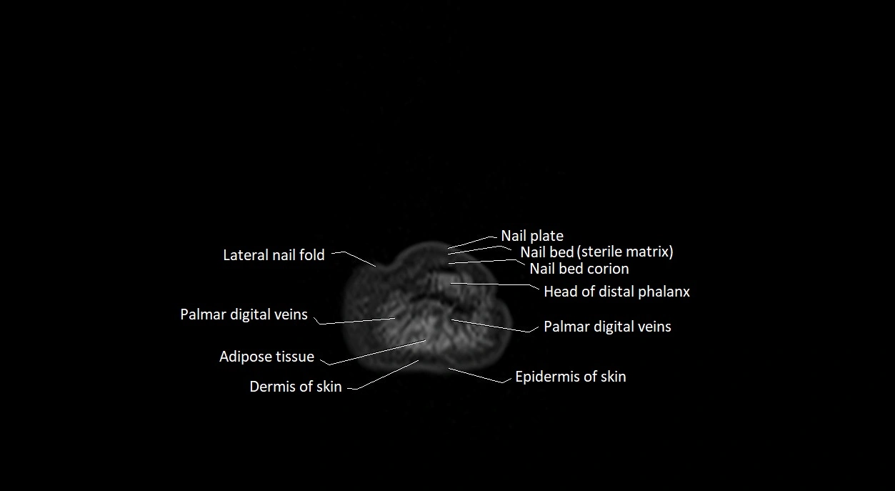 Finger anatomy axial cross sectional 3T image image 2.webp